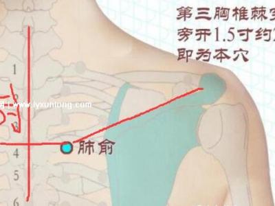 穴位肺俞的準(zhǔn)確位置圖片和功效，2個(gè)找肺俞最笨方法(止咳化痰)