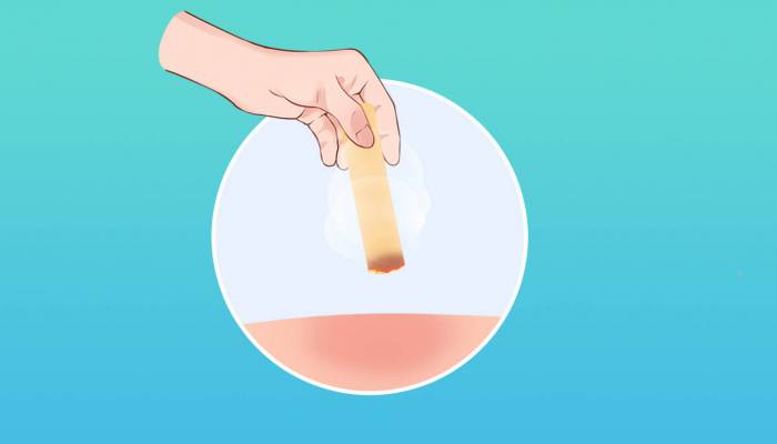 膝蓋疼艾灸哪個穴位 哪些人不適合艾灸