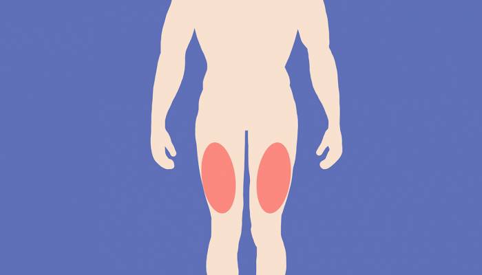 大腿外側(cè)有什么穴位 右大腿外側(cè)麻木怎么回事