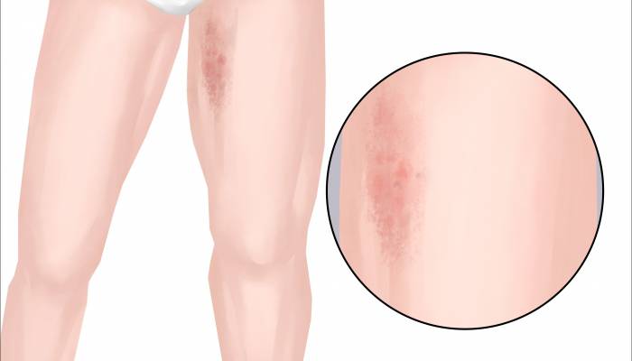 大腿內側是什么穴位 大腿內側是啥經絡