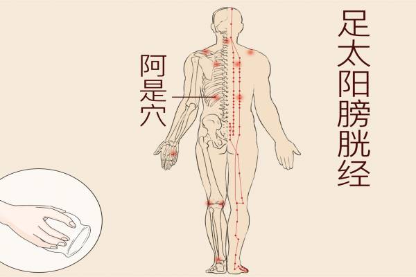 人身上有多少個穴位 人體身上有多少條經絡-易網健康<a href=http://www.aoa7937.com/jkys/ target=_blank class=infotextkey>養生</a>網 人身上有多少個穴位 人體身上有多少條經絡