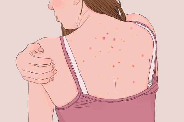 身體濕氣太重有什么危害 身體濕氣太重是什么原因造成的-易網<a href=http://www.aoa7937.com/ target=_blank class=infotextkey>健康養生</a>網 身體濕氣太重有什么危害 身體濕氣太重是什么原因造成的