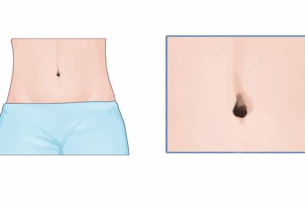 肚臍眼是什么穴位 什么是神闕穴-易網<a href=http://www.aoa7937.com/ target=_blank class=infotextkey>健康養生</a>網 肚臍眼是什么穴位 什么是神闕穴