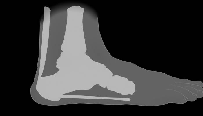 腳踝內側是什么穴位 刺激穴位時要注意什么-易網<a href=http://www.aoa7937.com/ target=_blank class=infotextkey>健康養生</a>網 腳踝內側是什么穴位 刺激穴位時要注意什么