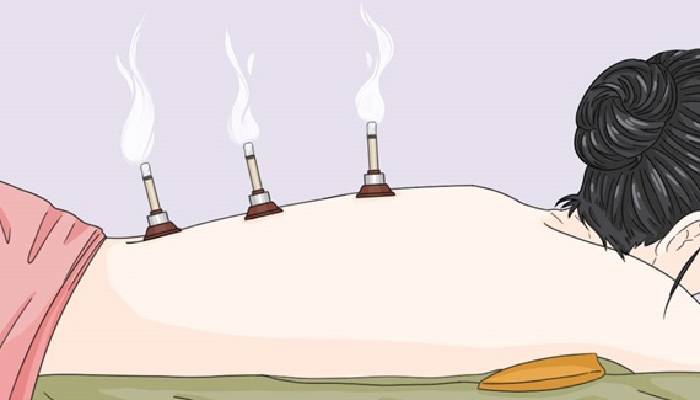 艾灸癢癢的是什么原因 應該如何避免出現癢