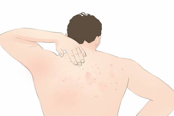 按摩八髎穴的好處 艾灸八髎是補(bǔ)還是泄