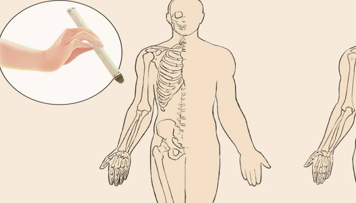 艾灸癢癢的是什么原因 應該如何避免出現癢