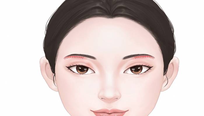 兩眉之間是什么穴位 兩眉之間叫印堂穴嗎