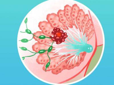 乳腺結節按摩哪個穴位 改善乳腺結節的按摩手法