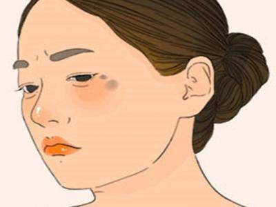 更年期祛斑，就是這么快速有效！