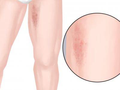 大腿內側是什么穴位 大腿內側是啥經絡