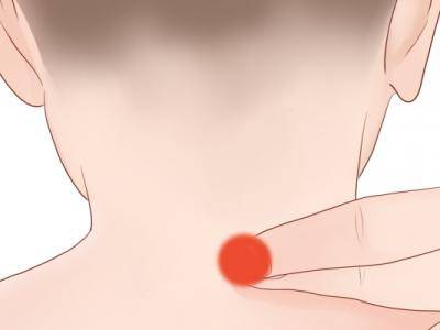 針灸按摩大椎穴的好處 針灸大椎穴有危險嗎