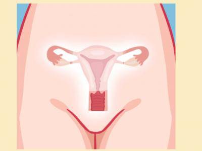 揭秘有關(guān)子宮畸形縱隔子宮的一切，如何預(yù)防