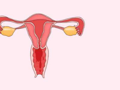 月經(jīng)周期怎么算最準(zhǔn)確？你知道嗎？