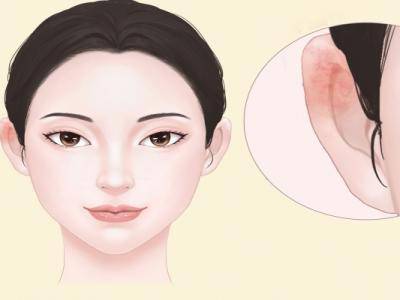 耳朵上面是什么穴位 耳朵上有什么穴位