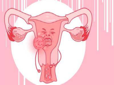 排卵期白帶有血絲是何原因？癥狀表現有哪些