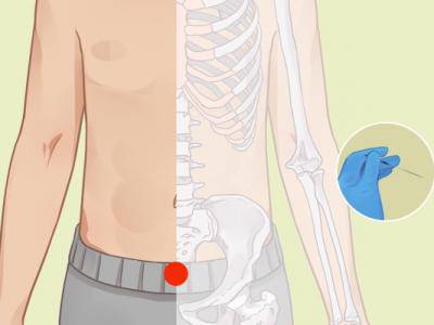 肚臍下三寸是什么穴位 女性肚臍下三指處疼是什么原因