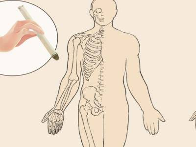艾灸癢癢的是什么原因 應該如何避免出現癢